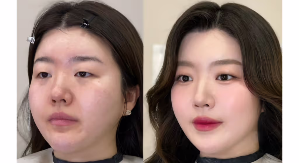 Seoul Private Tour - Before & After